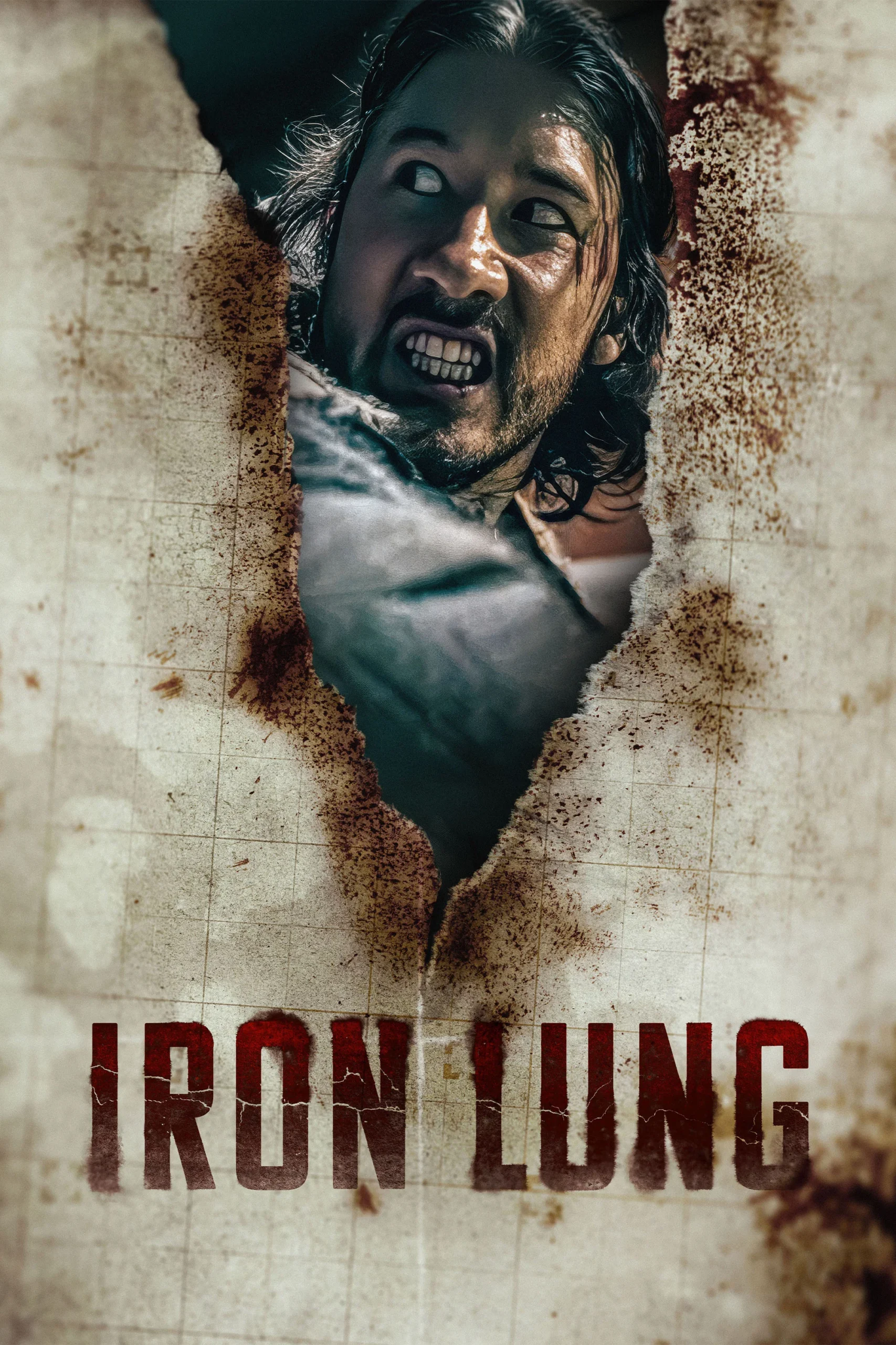 ریه آهنی (Iron Lung)